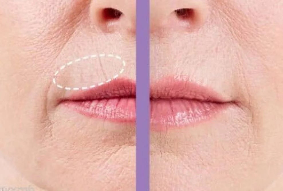 Bellahut Triple Smoothing Upper Lip Cream, .5 oz, with Decorinyl, Tri-Peptide-1 & Matrixyl 3000