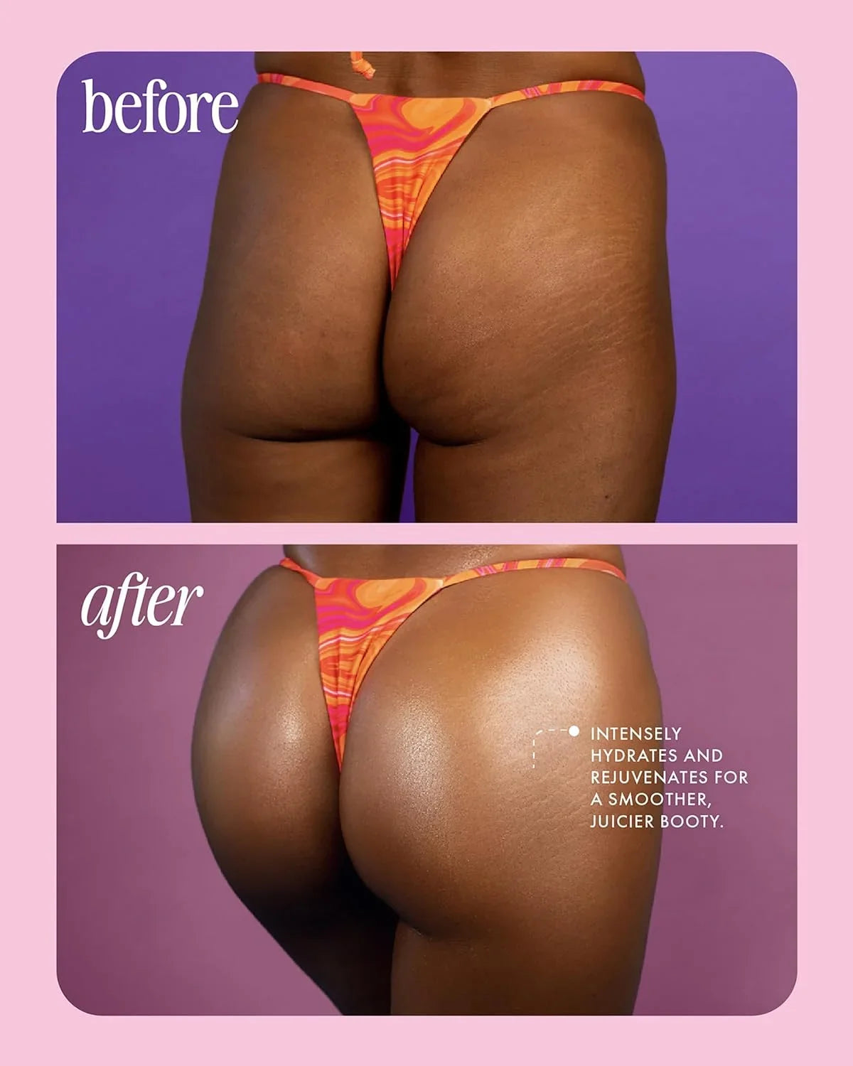Buns Of Glowry Tighten &amp; Glow Butt Serum
